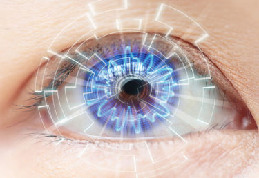 LASER MICROPULSO para Glaucoma e Retina