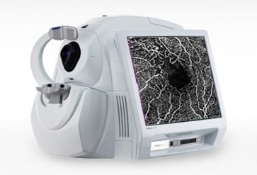 Angiografia por Tomografia de Coerência Óptica